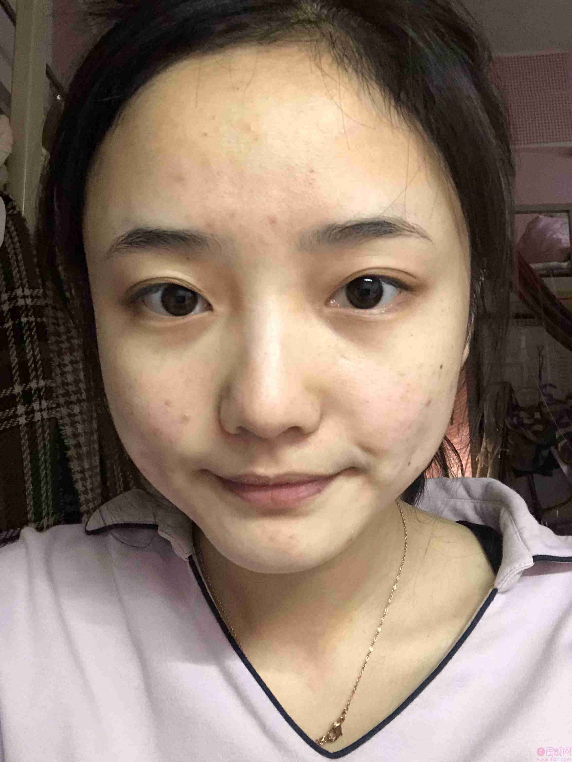 上海磨骨瘦脸手术多少钱？附案例及2020年价格表发布