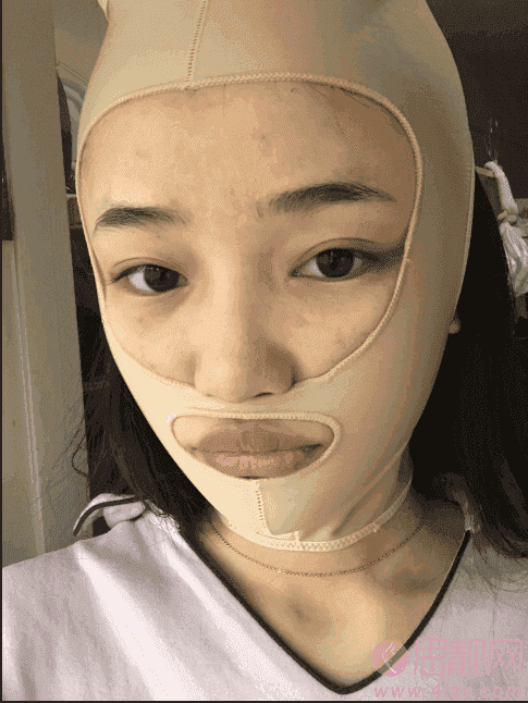 上海磨骨瘦脸手术多少钱？附案例及2020年价格表发布