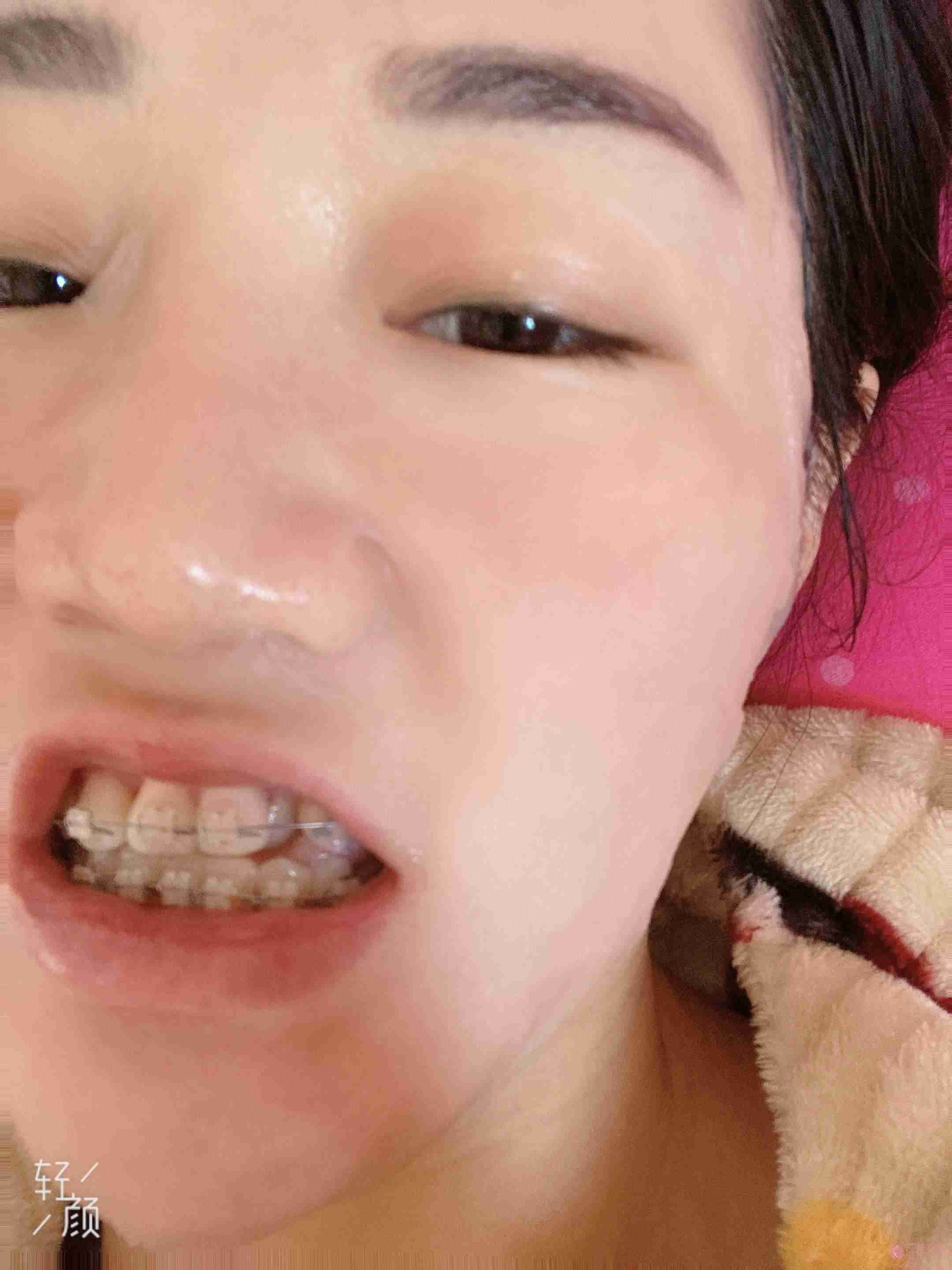 上海市王慧珍口腔诊所靠谱吗？2021价格表发布+牙齿矫正真人案例分享