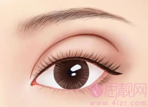 广州齐向东双眼皮价格是多少？医生实操眼部整形案例曝光！