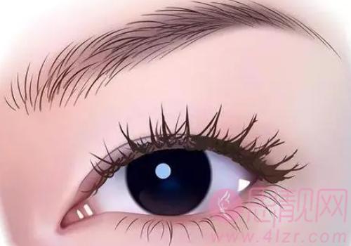 贵州利美康张会英医生，医生实力技术分析+双眼皮整形案例