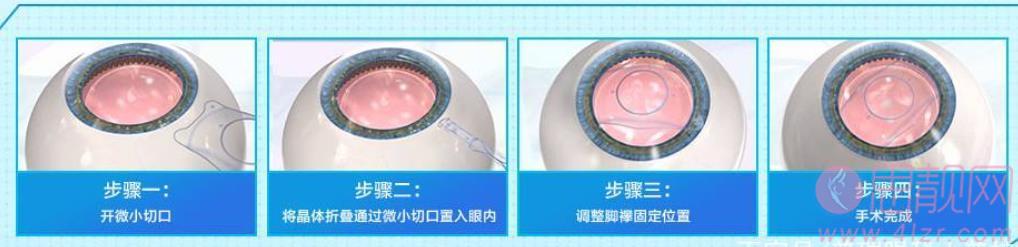 定西市第二人民医院眼科收费高不高？医院基本信息+真人近视眼调节<a href=