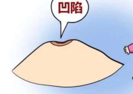 乳头内陷.jpg